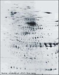 2DE von Haselnuss-Proteinen