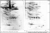 2DE von Plasma ohne und mit Proteinabreicherung